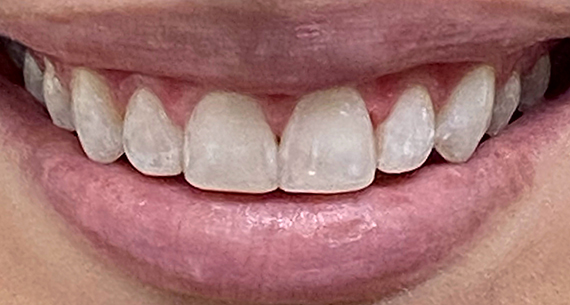 After