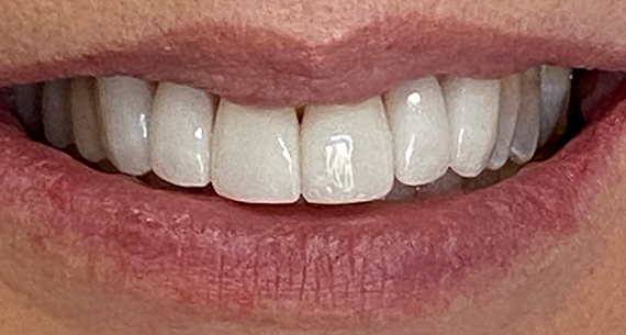 After